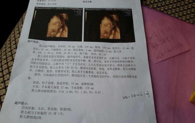 最新孕期B超检查时间表详解